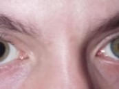 الوحيد في العالم.. ألماني يتحكم بحركة بؤبؤ العين