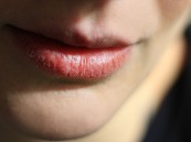 أربع أسباب صحية مقلقة وراء تشقق الشفاه