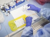 ابتكار علاج “مرض الفراشة” الوراثي النادر