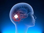 ماسك يعلن بدء تجارب شريحة المخ على البشر خلال 6 أشهر