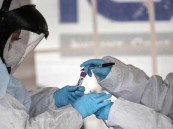 دراسة سعودية تثبت فاعلية مسيلات الدم في الحد من وفيات “كورونا”