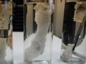 روسيا: ابتكار دواء لتجديد أنسجة العظام بعد الإصابات