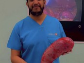 إنجاز طبي سعودي يُنهي معاناة “أربعيني” تجاوز وزنه 206 كجم!