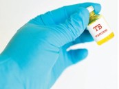 لقاح جديد للسل يثبت فاعليته وتحفيزه الاستجابة المناعية