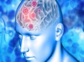 الأعراض الصامتة لمرض خطير في الدماغ.. ما علاقتها بالحمّام؟