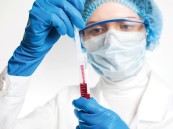 علماء يطورون نظامًا اصطناعيًّا لوقف النزيف الداخلي أثناء الحوادث