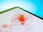 علاج جديد يستخدم خلايا دم المرضى لمحاربة الأورام