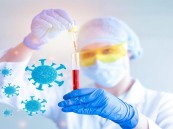 مبتعثة سعودية تتوصل إلى اكتشاف طبي يحمي من خطر الإصابة بمرض الكبد الدهني ومضاعفات كورونا