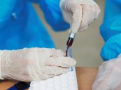 دراسة تثبت فاعلية اختبار الدم في التنبؤ بألزهايمر قبل 10 سنوات من الإصابة