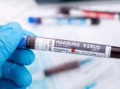 لا علاج له.. تعرف على أعراض فيروس “ماربورغ” وطرق الوقاية منه