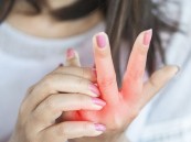 دراسة: 7 علامات “صامتة” على بشرتك لهذا المرض المزمن والخطير