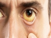 اذهب للطبيب فورا.. علامة تظهر في العين تنذر بمشكلة خطيرة