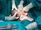 “الصحة” تطلق حملة توعوية عن العمليات القيصرية المخالفة والولادة المبكرة