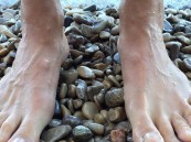 الإعلان رسمي.. اكتشاف علاج جديد لمرض الورم الفطري