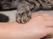 احذروا.. عض أو خربشة القطط تُحدث عدوى خطيرة