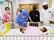 إنفاذًا لتوجيهات القيادة الرشيدة.. بدء عملية فصل التوأم السيامي النيجيري “حسنة وحسينة”