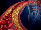 استشاري أمراض القلب يكشف عن أساليب غير دوائية تخفض الكوليسترول