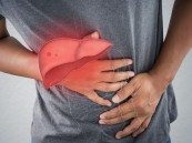 أعراض التهابات الكبد الحاد.. 8 علامات مؤكدة لا تهملها