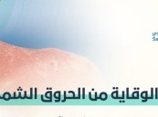 طرق مهمة للوقاية من الحروق الشمسية يكشفها المجلس الصحي