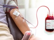 فوائد متعددة للتبرع بالدم تكشفها استشارية طب الأسرة.. تحسن الحالة المزاجية