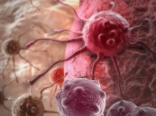 احذر منها.. 5 عادات شائعة تزيد خطر الإصابة بالسرطان