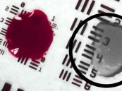 تقدم هائل.. ابتكار طبي يُخفي الدم أثناء الجراحة ويمنح الأطباء رؤية غير مسبوقة