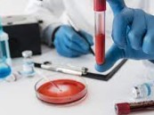 استشاري القلب: فحوصات طبية غير مبررة قد تضر المريض