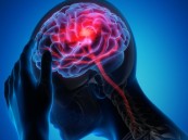 تحذير من أخطر مسببات الجلطات الخفية لدى الشباب.. متخصص يكشف