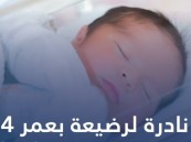 عملية نادرة لرَضيعة بعمر 4 أشهر في مستشفى الجبر بالأحساء