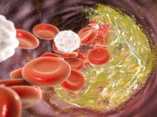 تحذير خطير.. متخصص يكشف كيف يدمّر “الكوليسترول” جسدك بصمت