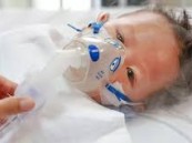 الالتهاب الرئوي يهدد الأطفال دون الخامسة.. طبيب يحذر ويؤكد: الكشف المبكر ينقذ الحياة