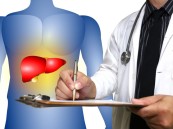 المسموح والممنوع.. استشاري كبد يحدد شروط صيام مرضى تليّف وزراعة الكبد خلال رمضان