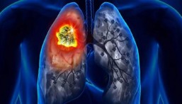 “الغذاء والدواء الأمريكية” توافق على عقار جديد مضاد لسرطان الرئة