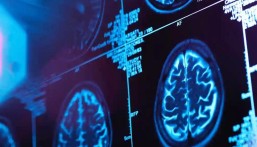 أمريكا تجيز دواءً جديداً لعلاج مرضى الزهايمر