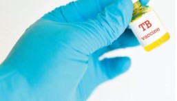 لقاح جديد للسل يثبت فاعليته وتحفيزه الاستجابة المناعية