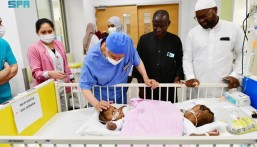 إنفاذًا لتوجيهات القيادة الرشيدة.. بدء عملية فصل التوأم السيامي النيجيري “حسنة وحسينة”