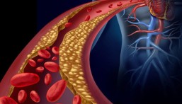 استشاري أمراض القلب يكشف عن أساليب غير دوائية تخفض الكوليسترول