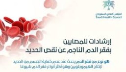  نصائح مهمة لمصابي فقر الدم بسبب نقص الحديد.. احذر من هذه المشروبات