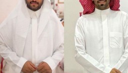 إنسانية تتجلى في الأحساء.. مواطن يتبرع بكليته ليُنقذ حياة ابن عمه من معاناة ضعف الكلى