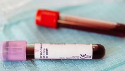  تصل للوفاة.. اختلاف نتائج اختبارات وظائف الكلى يُنذر بمخاطر صحية