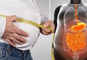 استشاري أمراض القلب: خسارة 5% من الوزن تقلل الدهون الحشوية 4 أضعاف