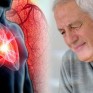 تصل لـ 40% لدى بعض الحالات.. كيف يؤثر الاكتئاب على فرص تعافي مرضى القلب من الجلطات؟