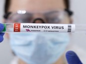 بريطانيا: اللقاح المضاد لجدري القردة فعال بنسبة 78%