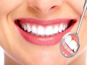 6 تقليعات جديدة للصحة والجمال تؤثر على الأسنان