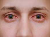 3 نصائح للتخلص من أكثر مشاكل العينين شيوعًا
