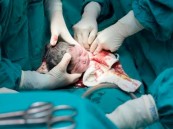 “الصحة” تطلق حملة توعوية عن العمليات القيصرية المخالفة والولادة المبكرة