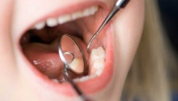 بنسبة 35%.. بدء تنفيذ قرار توطين مهن طب الأسنان