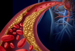 استشاري أمراض القلب يكشف عن أساليب غير دوائية تخفض الكوليسترول