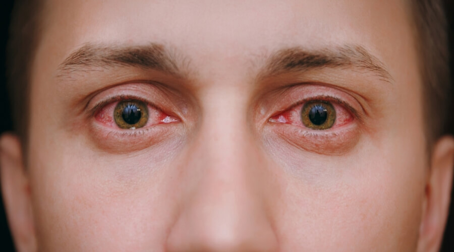 3 نصائح للتخلص من أكثر مشاكل العينين شيوعًا