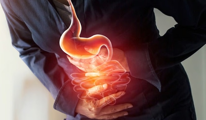 كيف تحافظ على معدتك؟.. تعرف على أسباب اضطرابات المعدة وطرق التغذية السليمة